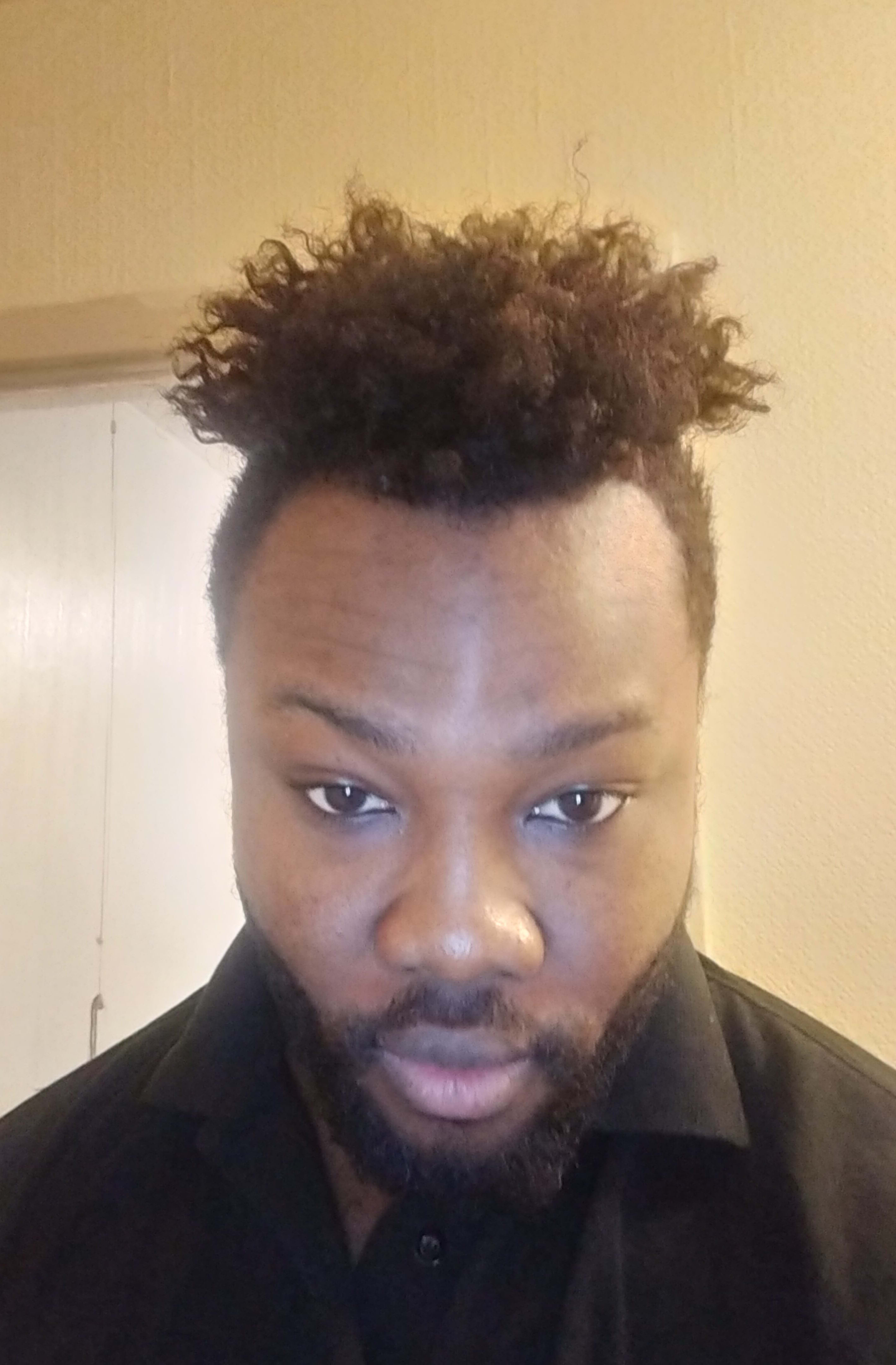 Fredrick Agyei Twum - Project Casting Fredrick Agyei Twum - Profile Photo