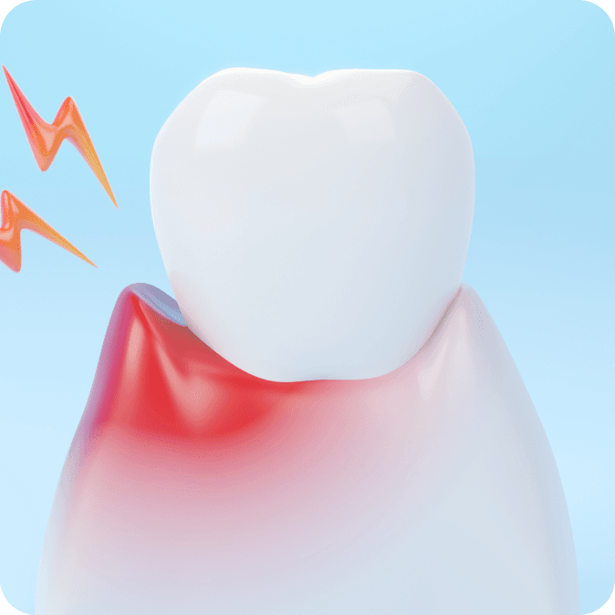 Tooth Inflammation