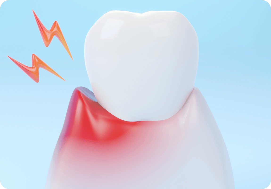 Tooth Inflammation