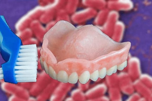 A Detailed Note On Suction Cup Dentures By Pro Remarks