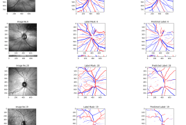 Medical Image Colorization with U-Net CNN: Segmentation of retinal arteries and veins in RAVIR dataset
