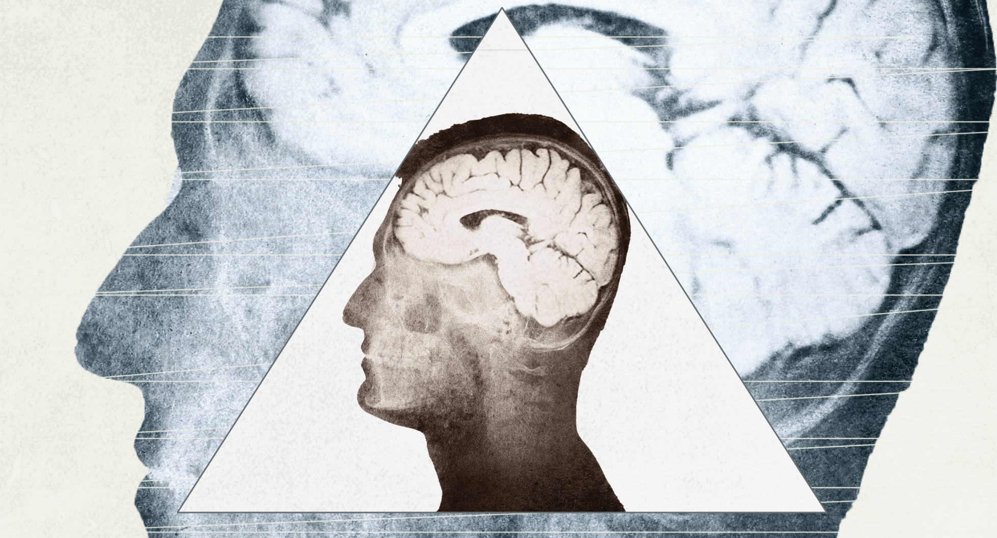 Helping Chronically Depressed Patients Move Forward