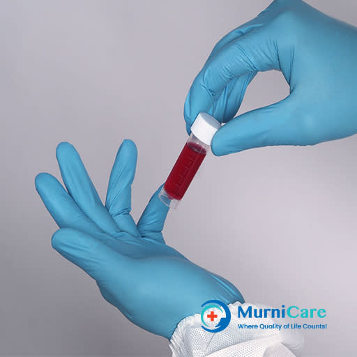 what is a titer test for humans | antibody titer – BEWK