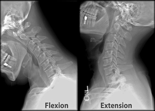 Soft Tissue Injury