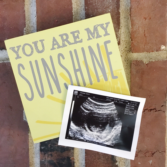 picture of ultrasound next to a word block that says 'you are my sunshine'