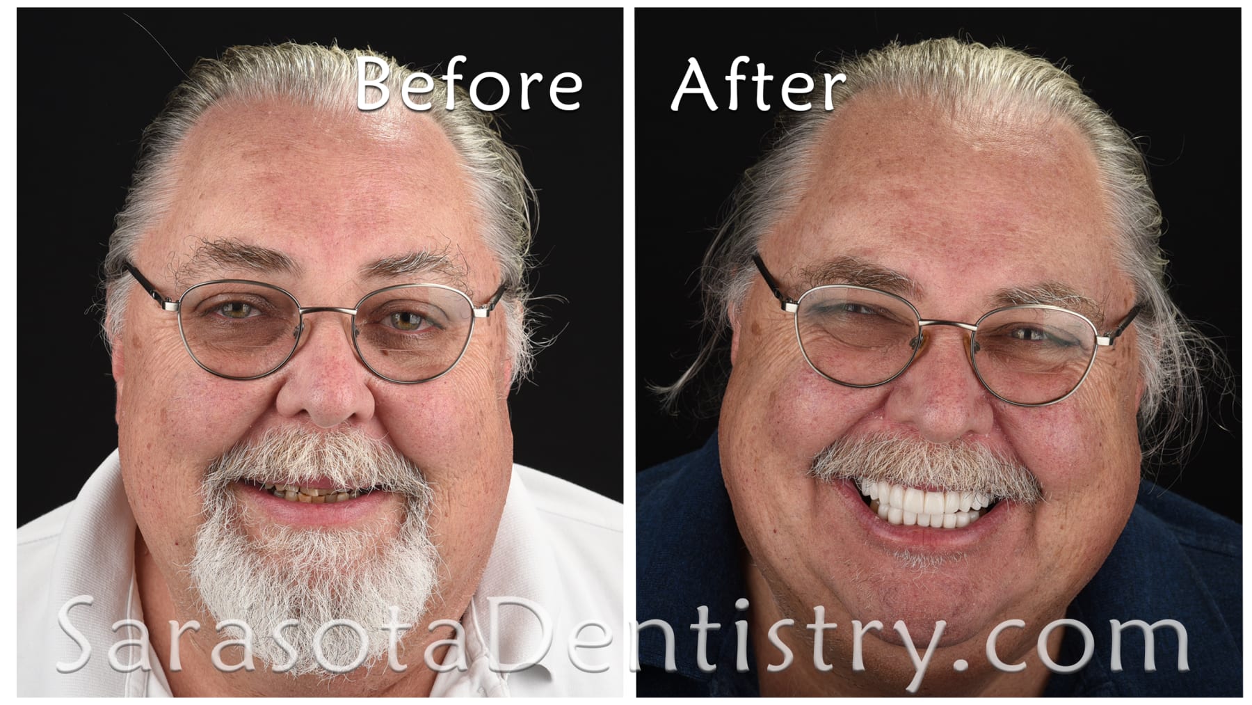 Smile Makeover to the Max — view 1