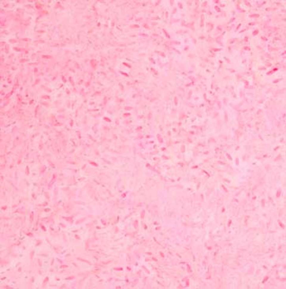 Northcott - Ketan - 81000-210