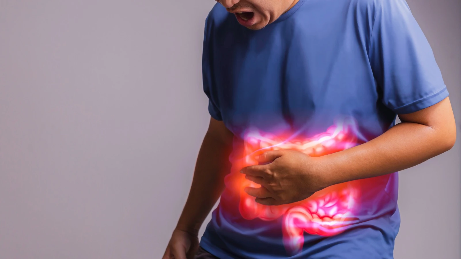 Understanding Irritable Bowel Syndrome