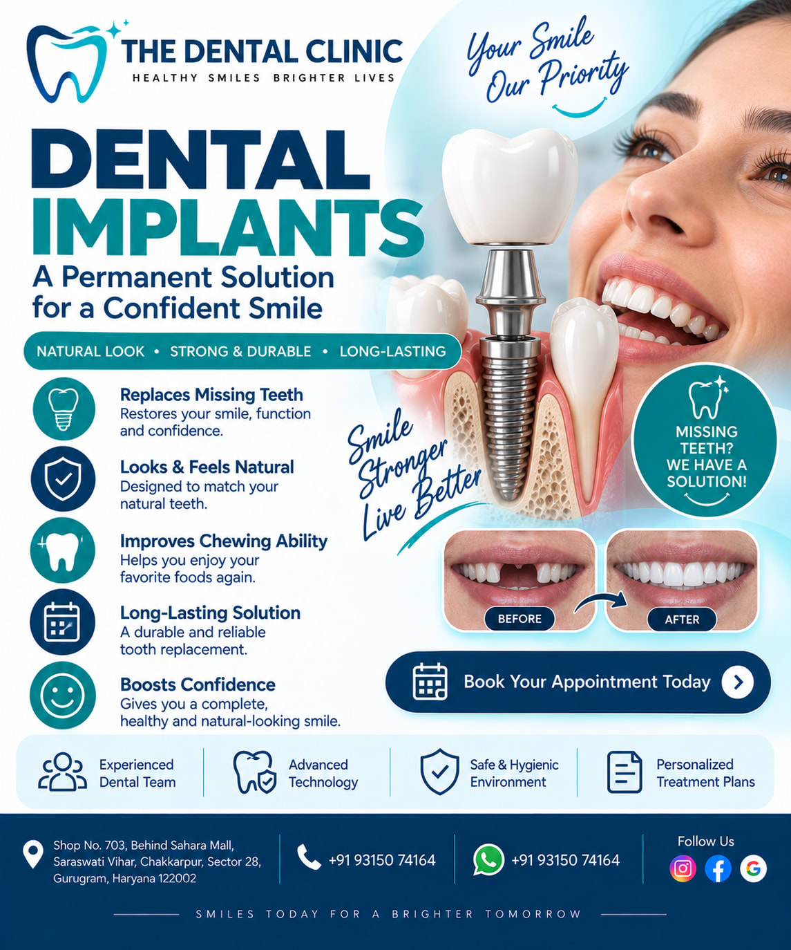 Dental Implants