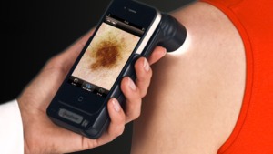 El CAP implanta la Teledermatologia