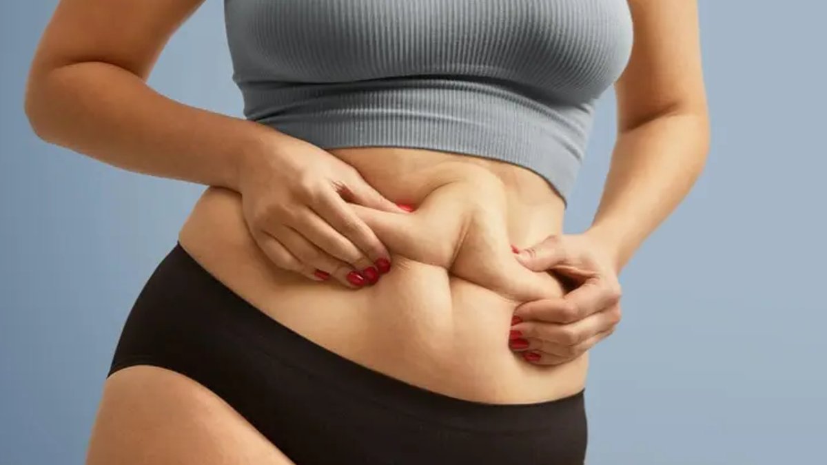 Experts Advise When a Tummy Tuck Is Needed Experts Advise When a Tummy Tuck Is Needed - tummy tuck