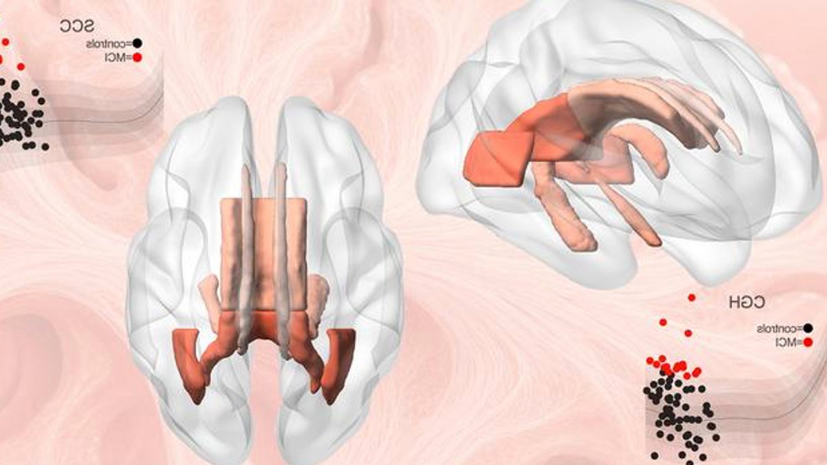 New brain map charts neural aging process New brain map charts neural aging process - brain aging