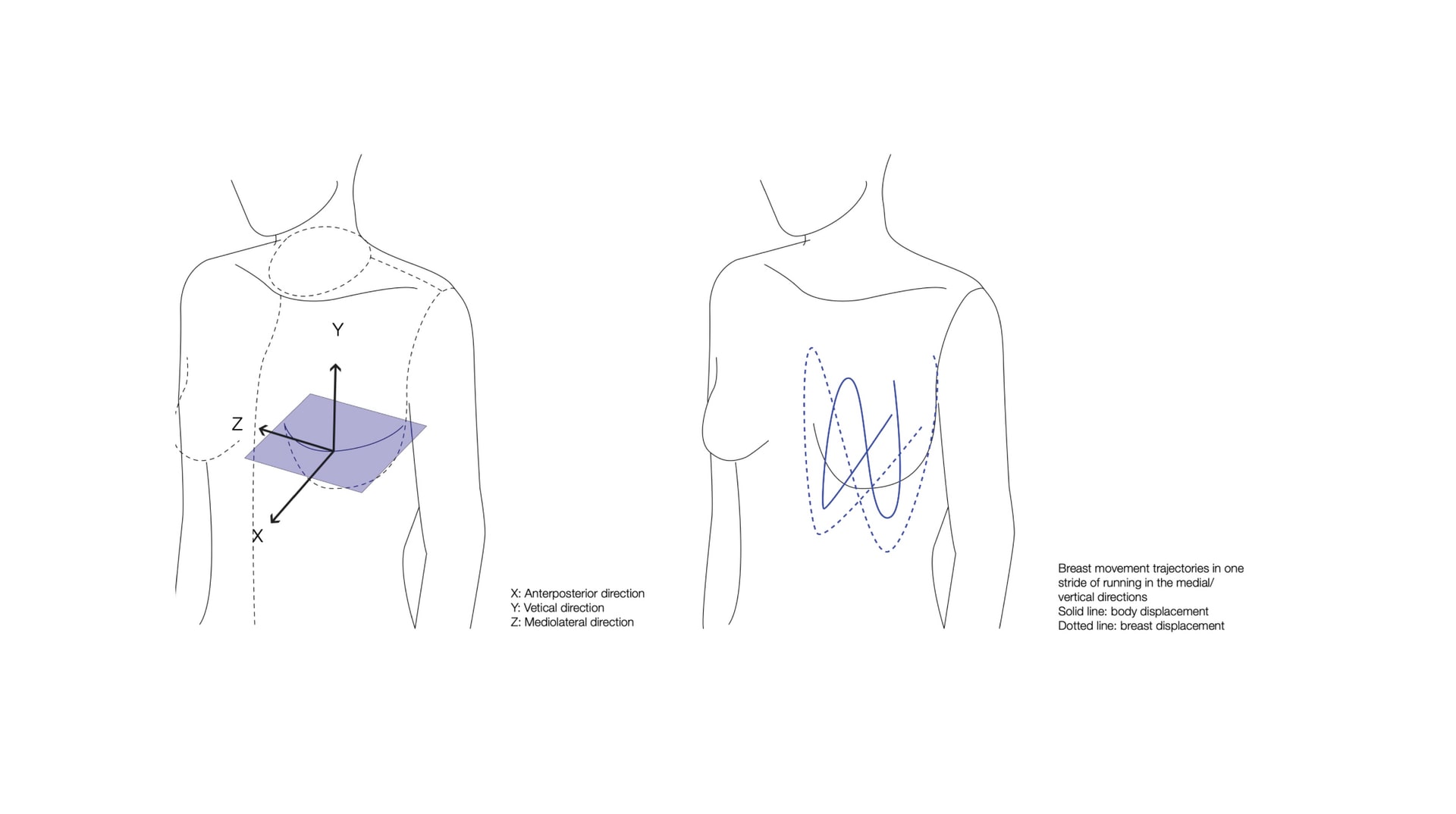 Biomechanics of breast displacement