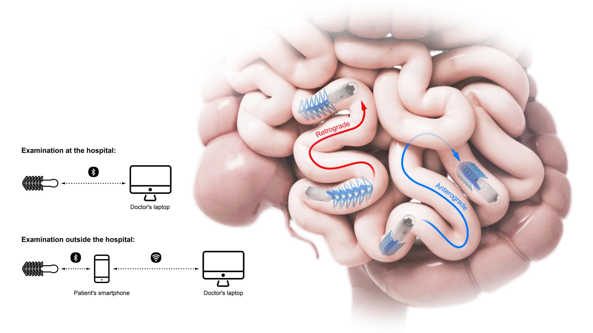 ORCA can be connected to the doctor’s laptop via Bluetooth Low Energy if the patient needs to stay in the hospital. The data such as images recorded by the capsule will be uploaded to a special APP fo