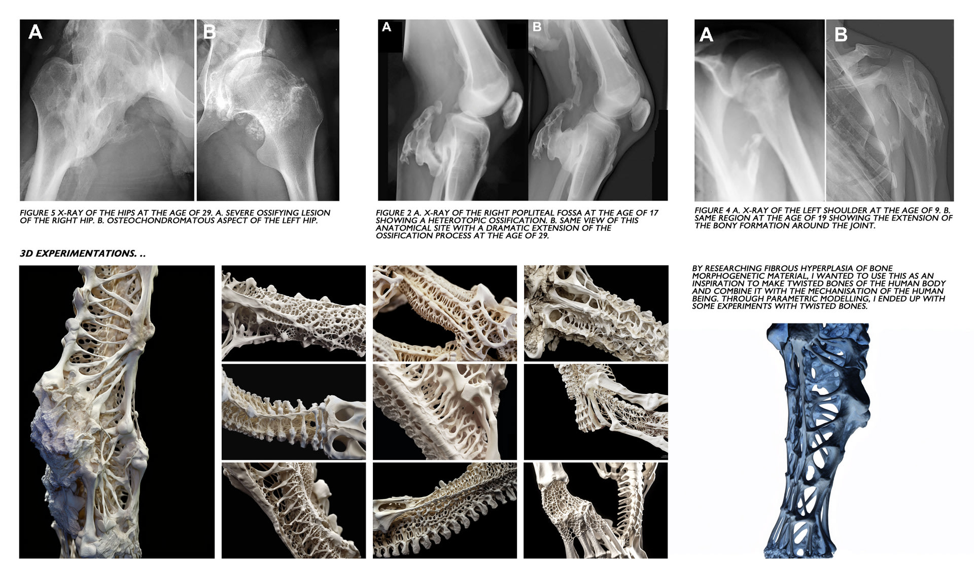 Mutated Skeleton