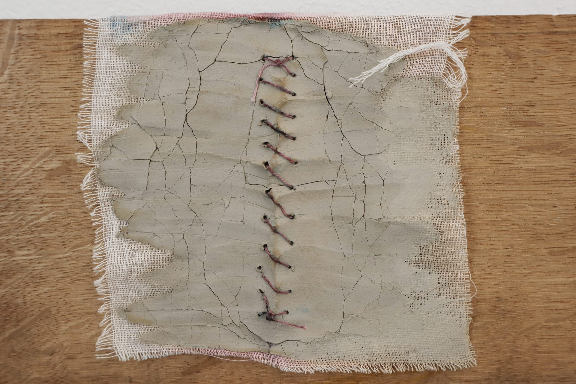 surgical suture stitching