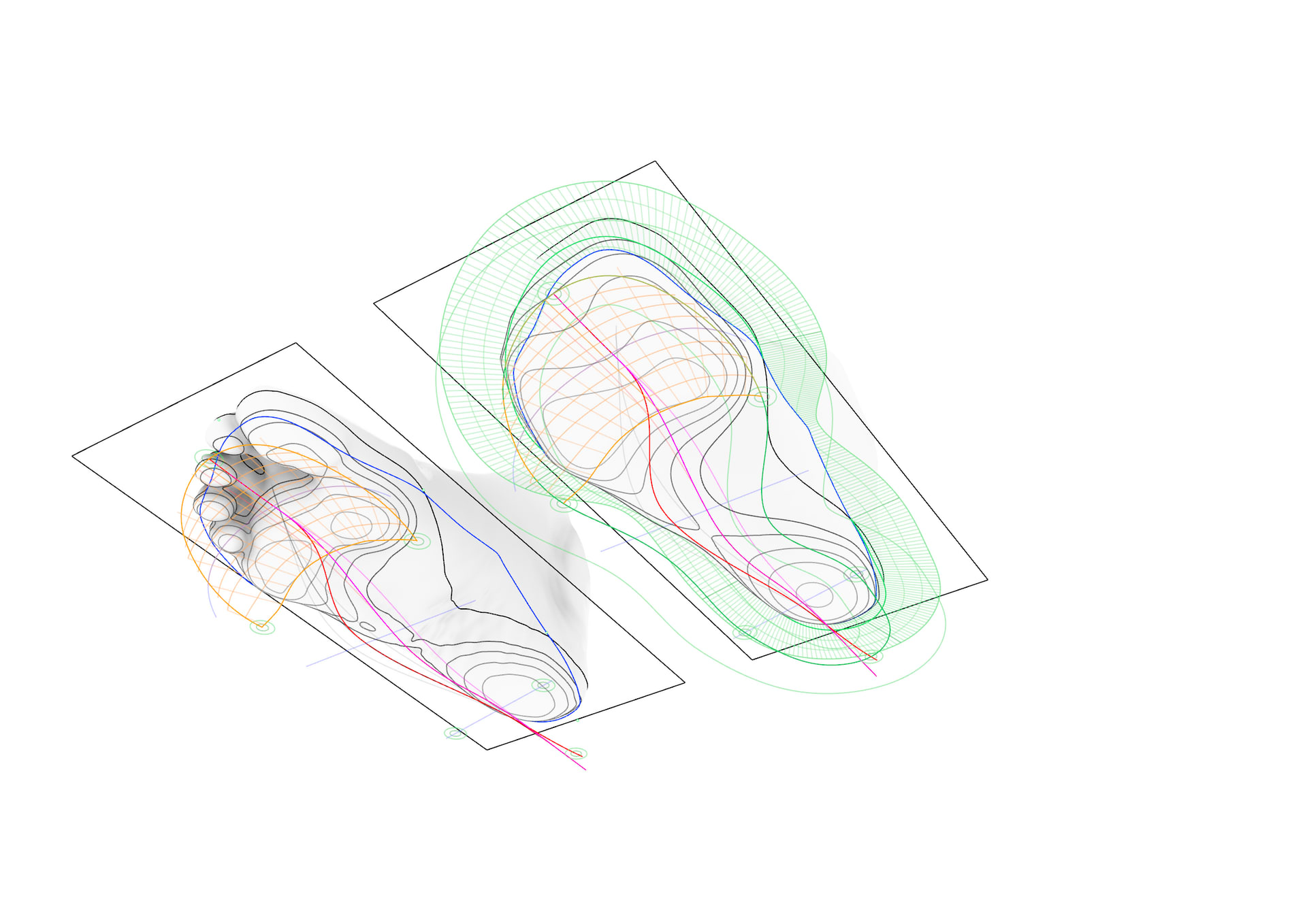 ARCH FOOT ANALYSIS