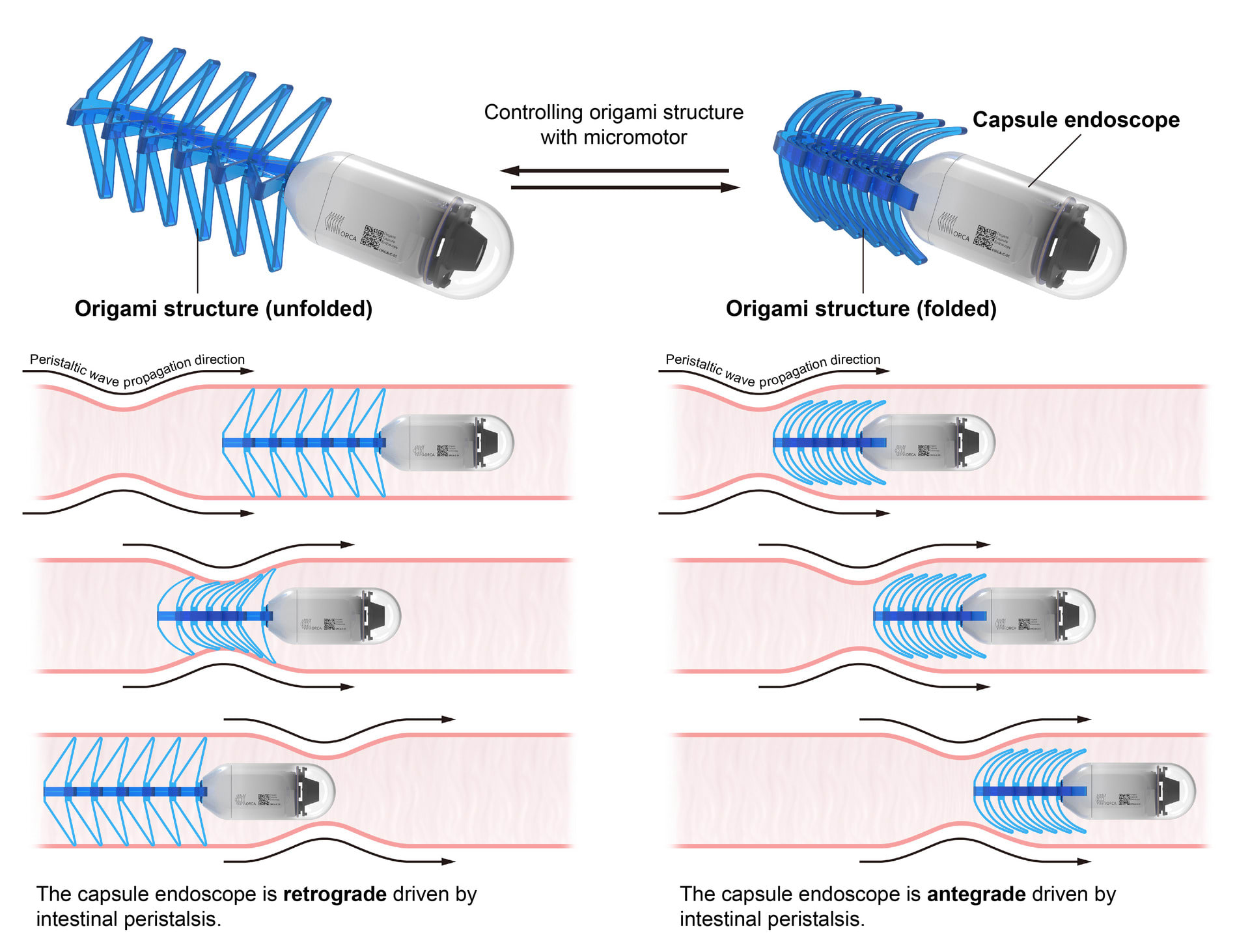 ORCA has a special origami structure. When the origami structure is folded, ORCA is propelled forward by intestinal peristalsis. When the origami structure is unfolded, the intestinal peristalsis sque