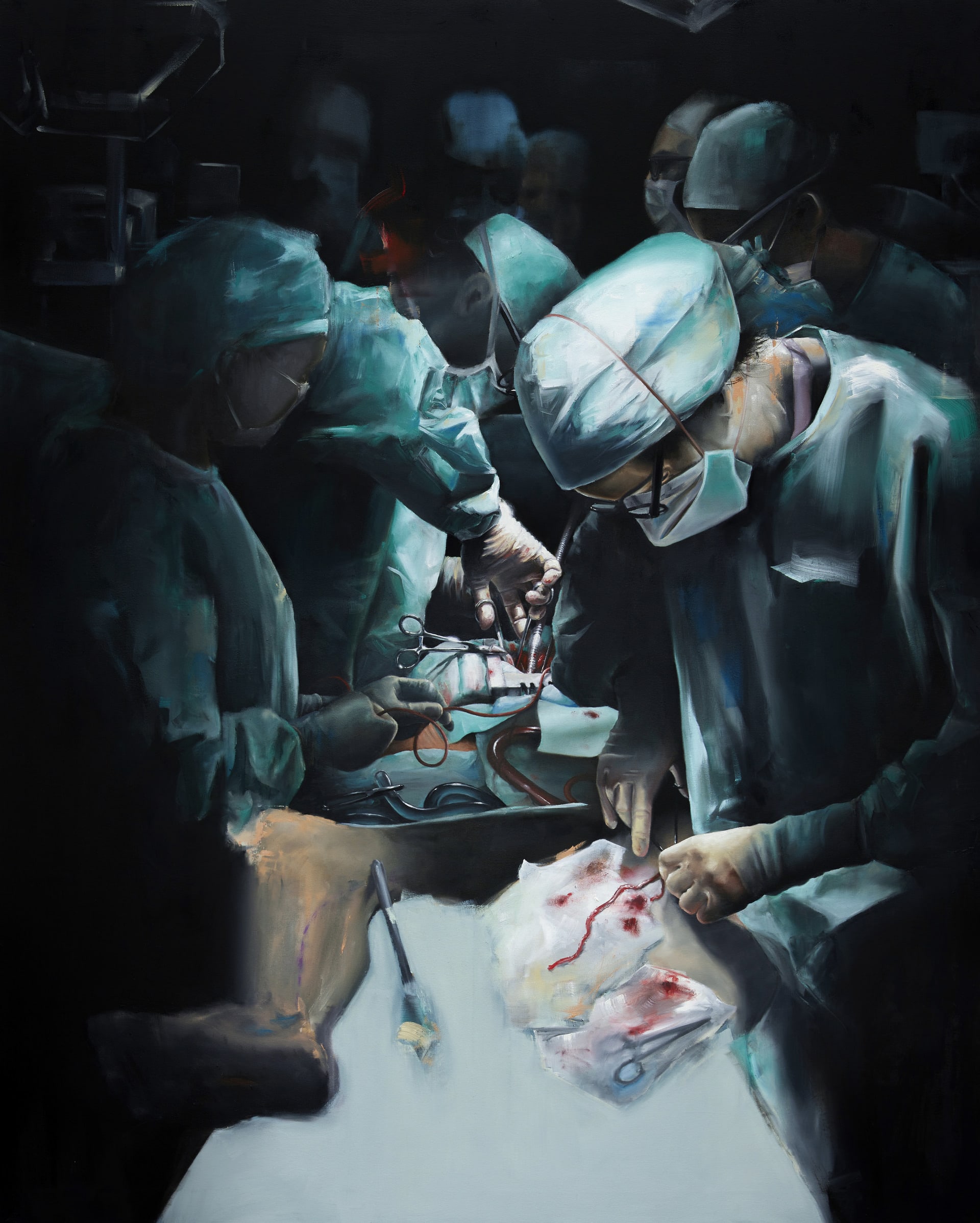 surgical scene, latex gloves holding a freshly harvested vein whilst surgical team stand over a body.