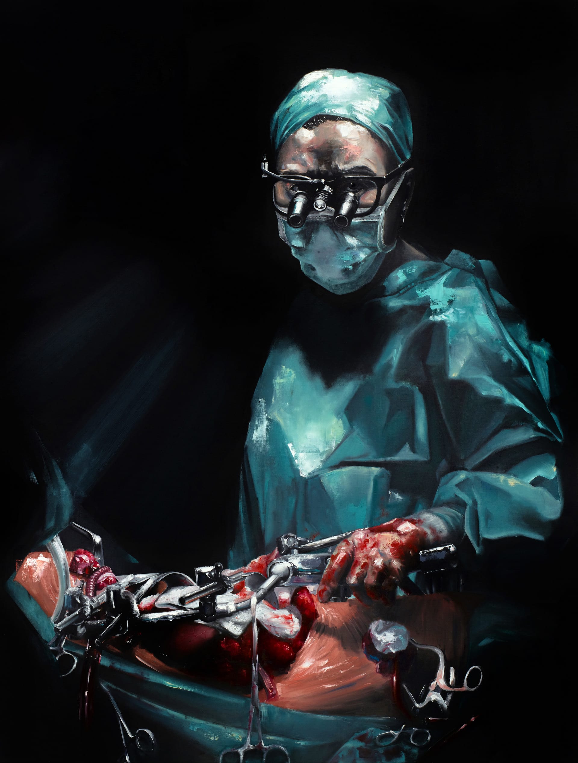 Surgeon stands over an open chest [patient for aorta replacement. 