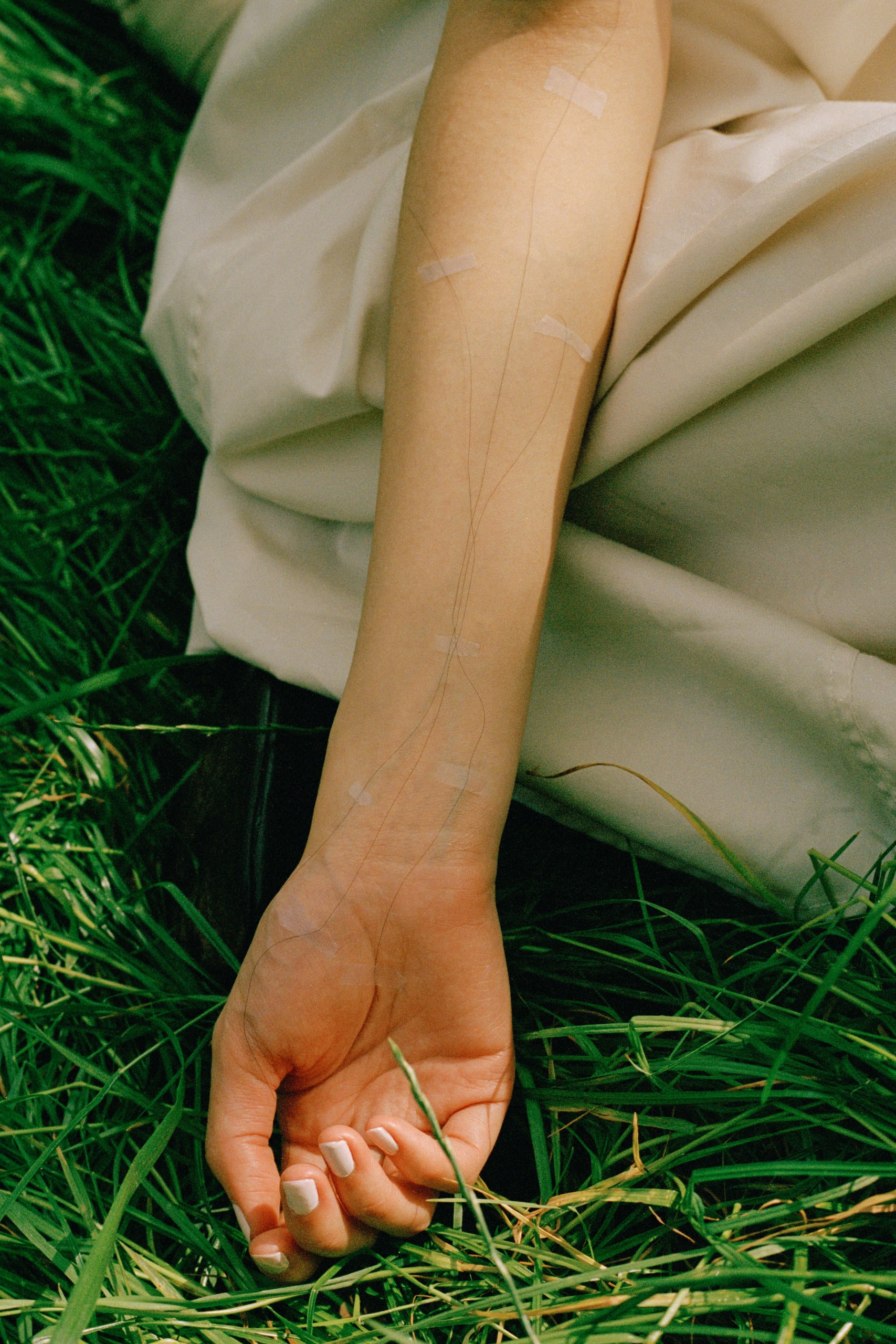 A drooping arm, some hair sticked on the arm along the vessels.