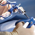 Prendre rendez-vous avec   DAN LIVIU VASILE Chirurgie G&eacute;n&eacute;rale à Moulins