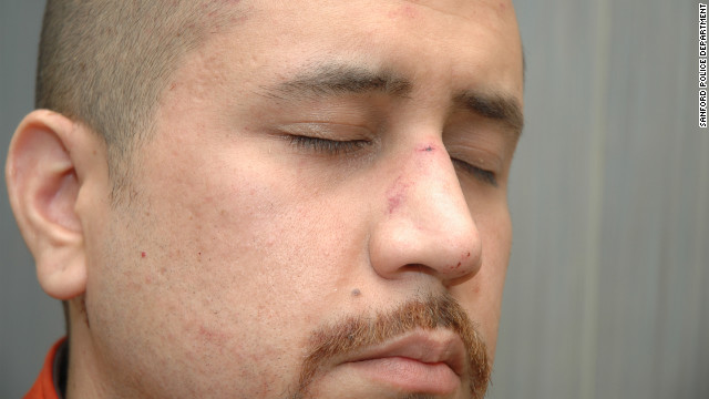 120517105610-zimmerman-nose-horizontal-gallery