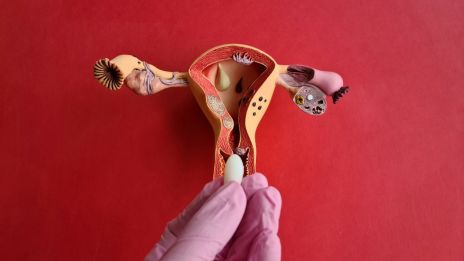 Hogyan Kezeld a Kellemetlenséget Természetes Módszerekkel?