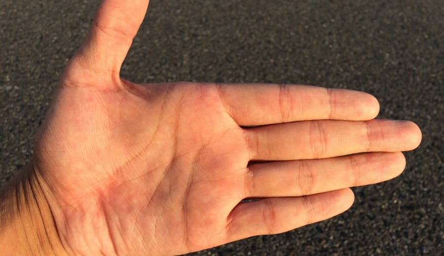 Tenyérjóslás 2. Más vonalak – Egészségvonal