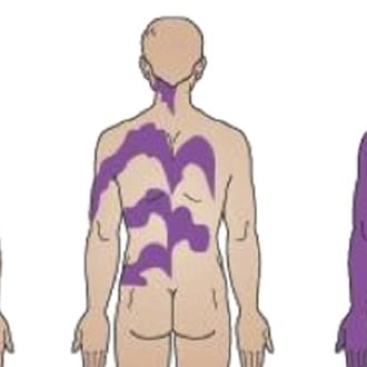 More like: Scientists Have Invented a Simple New Test For…