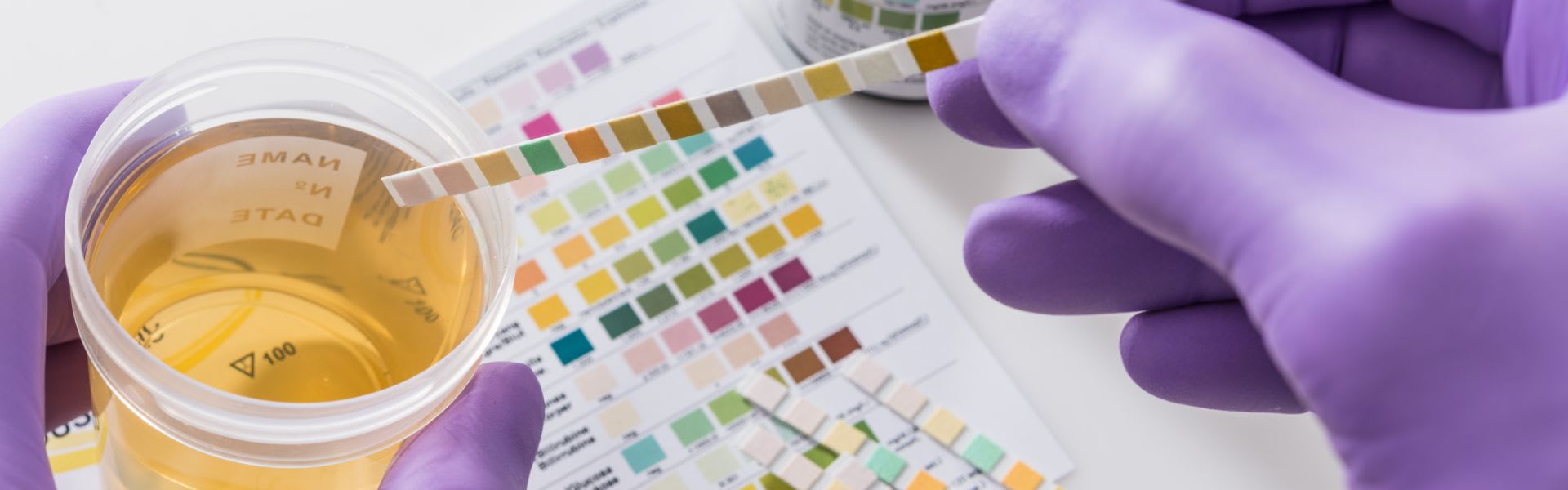 Navigating Pre-Employment Drug Screening: Identifying the Substances Tested