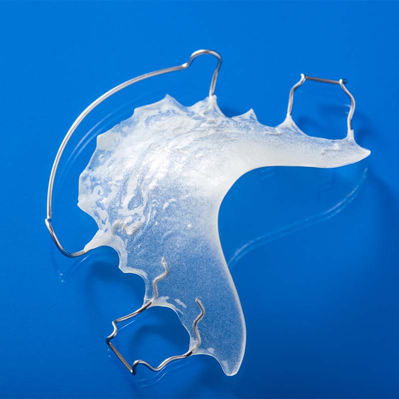 Removable, Hawley-style retainer made of acrylic and metal wire