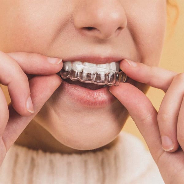 Teen putting clear aligner tray into mouth