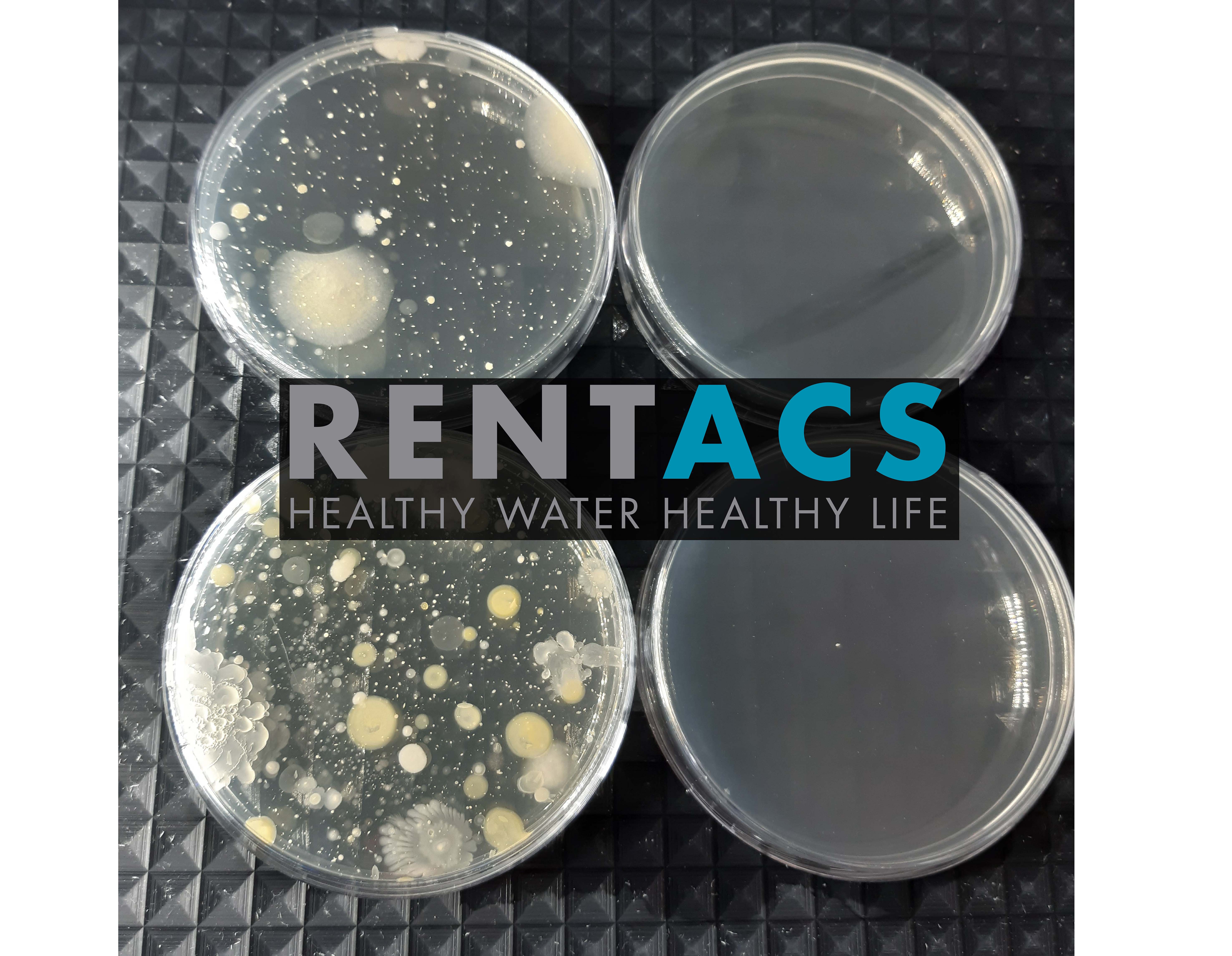Disinfezione ambientale risultati microbiologici