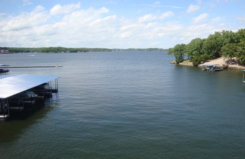 Lake view at Parkview Bay and Tower Condos.