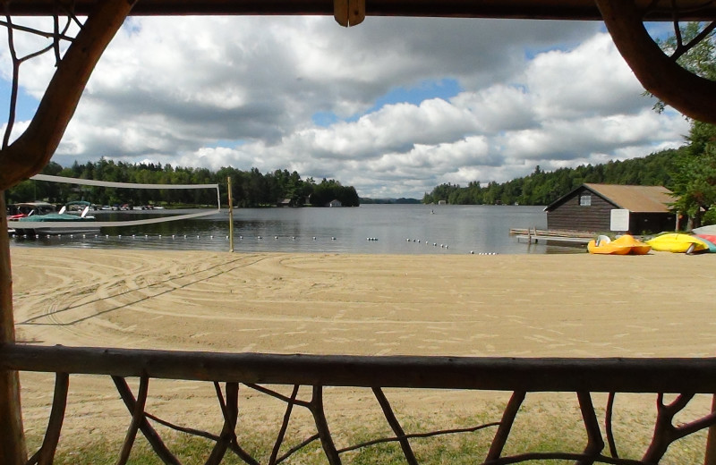 Common Area and Beach View from Ampersand Bay Resort & Boat Club.