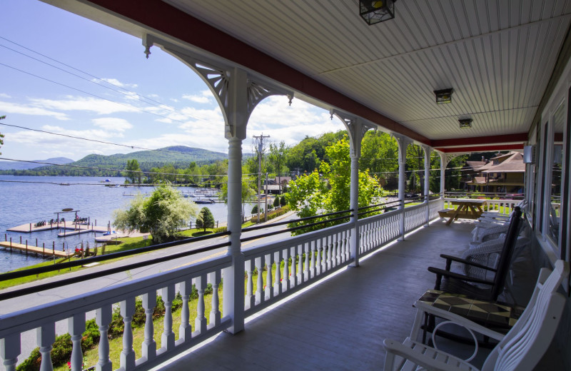 Rental balcony at Trout House Village Resort.