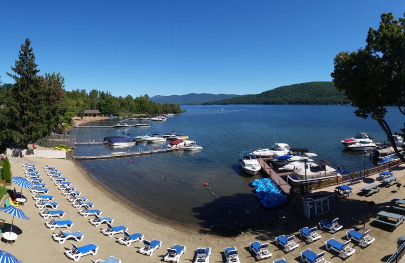 Beach at Surfside on the Lake Hotel & Suites.