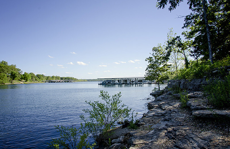 Lake view at Branson Vacation Houses.