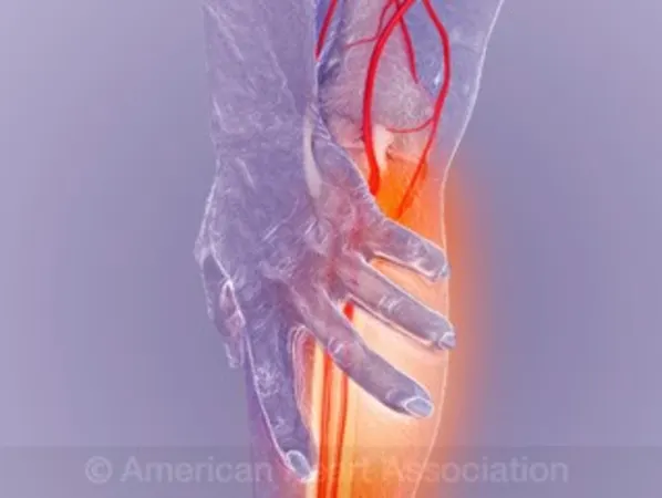 Peripheral Artery Disease (PAD)