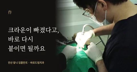 크라운·브리지 탈락 후 자연치아 상태를 확인하는 치과 칼럼 대표 이미지