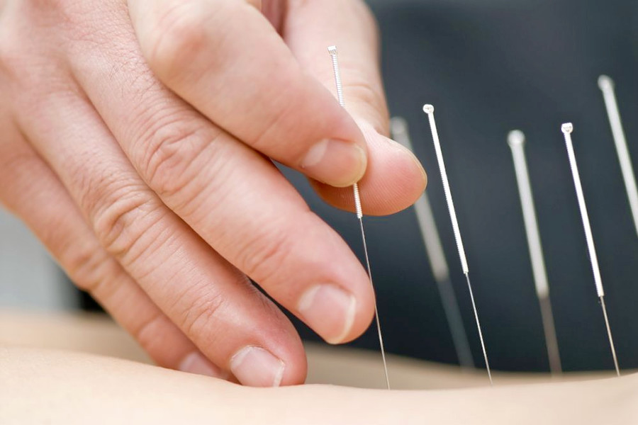 The 5 best acupuncture spots in St. Louis