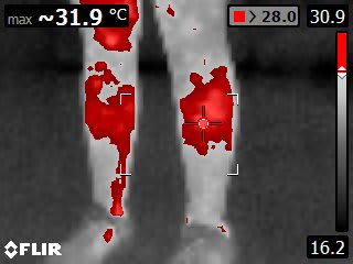 Thermal Image of Legs