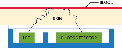 医療モニタリング用スマートウェアラブルモニタリングデバイスの設計