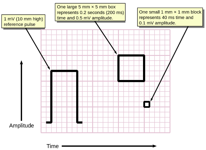 ECG_GRAPH_PAPER1_16587ee7f8dc3801a02b712151914a089ae70cb6.png