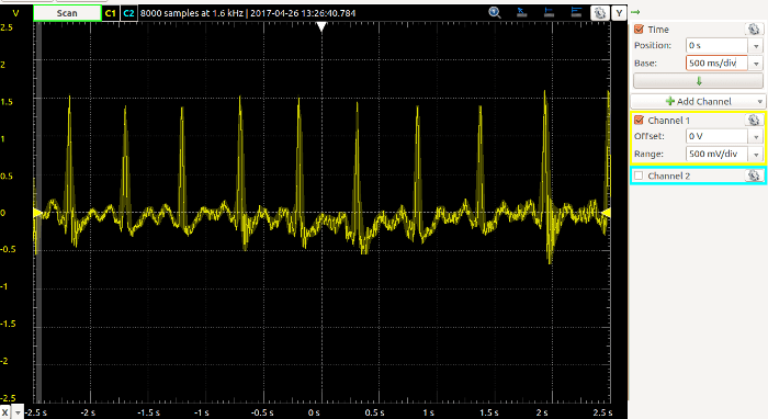 ECG_TRACE1_145e43794898510453132d9f77140d777fef8167.png