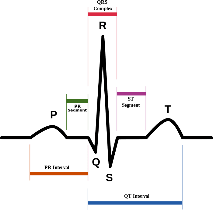 ECG_WAVE_1d3de63c244ddd9337257820d3c576f09426369d.png