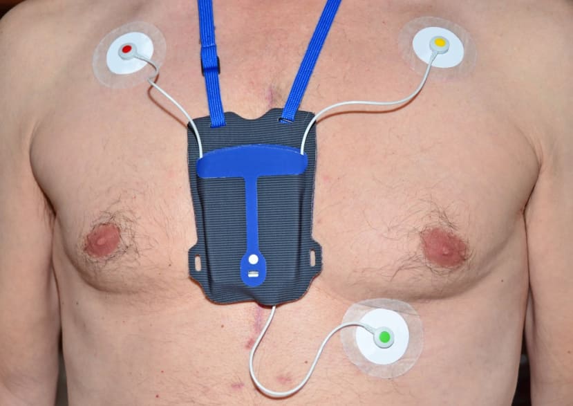 ecg_portable_monitoring_9b4f91653a3252a5902786b4536e645b44f78af3.jpg