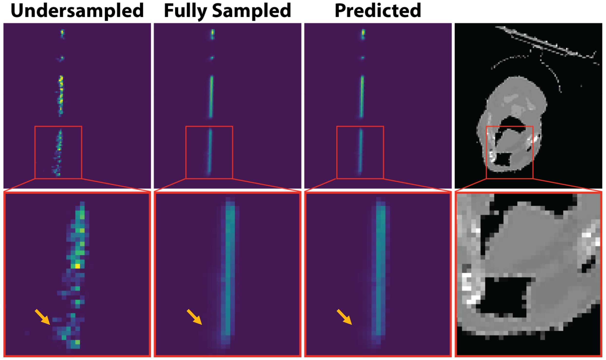 Deep Monte Carlo Dose Denoising