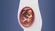 Artificial Placenta — video thumbnail